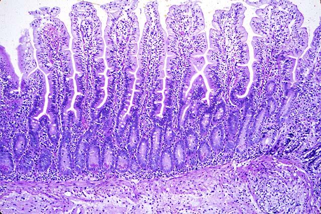 Disturbo Immunitario